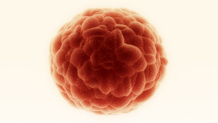 Inflammation et cancer : quel lien ? Image d'une cellule cancéreuse et qui s'est multipliée. On remarque l'aspect granuleux.