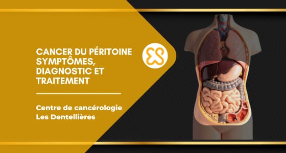 Cancer du péritoine – symptômes, diagnostic et traitement