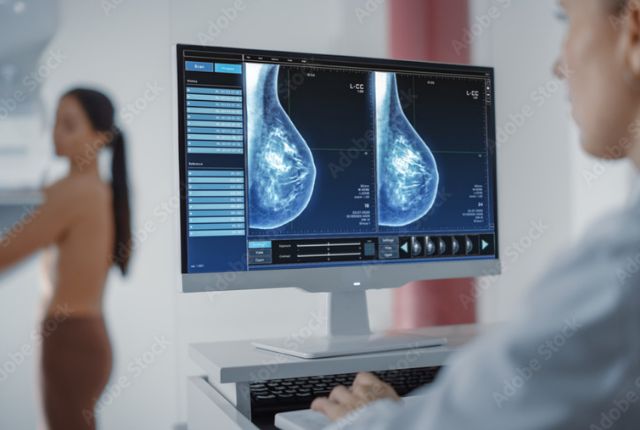 Excellents résultats de l'Enhertu dans le cancer du sein HER2 métastasé. Image d'une femme passant une mammographie et d'un soignant devant son écran de contrôle.