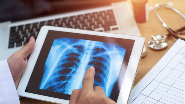 Chirurgie cardiovasculaire et thoracique