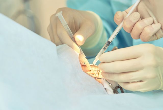 Champ opératoire. La chirurgie de la main est ouverte aux patients étrangers à la Clinique Bouchard de Marseille.