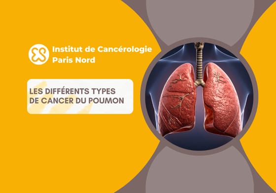 Les différents types de cancer du poumon