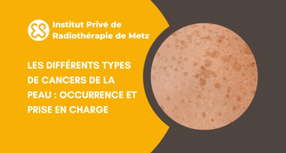 Les différents types de cancers de la peau