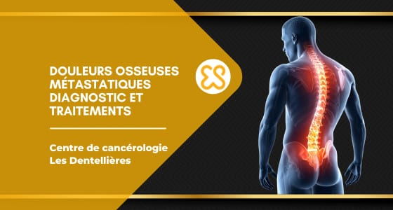 Douleurs osseuses métastatiques - Diagnostic et traitements