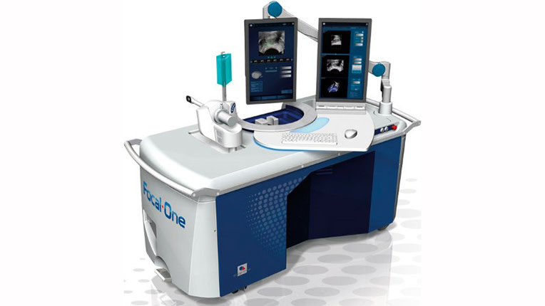 Focal One : Un traitement innovant du cancer de la prostate