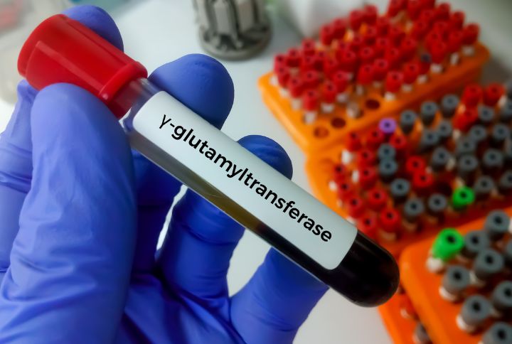 Gamma GT élévé : tube de prise de sang pour l'analyse de Gamma GT tenu par la main gantée d'un soignant.