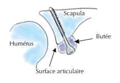 dessin explicatif de l'intervention de la butee de l'epaule clinique du parc lyon