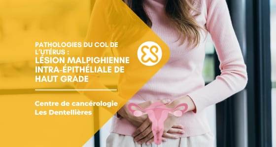 Lésion malpighienne intra-épithéliale de haut grade - Pathologies du col de l’utérus