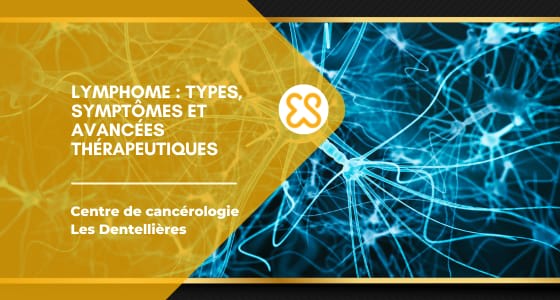Lymphome : types, symptômes et avancées thérapeutiques
