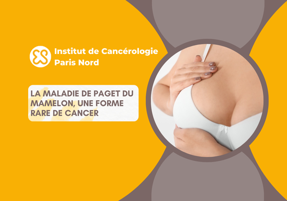 La maladie de Paget du mamelon, une forme rare de cancer