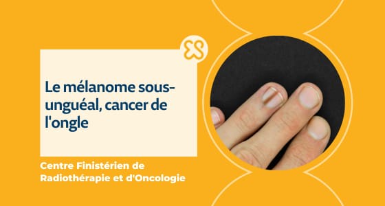 Mélanome sous-unguéal - Cancer de l'ongle