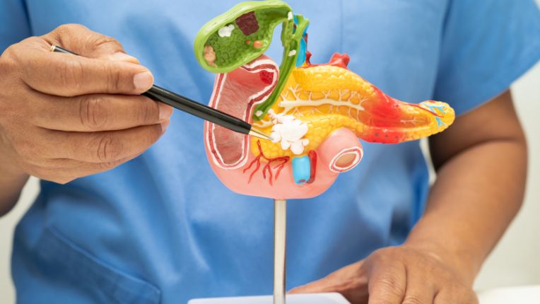 Opération du pancréas par robot à Toulouse. Un soignant désigne sur un modèle anatomique en 3D le pancréas, situé en dessous de la vésicule biliaire.