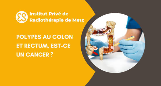 Polypes au côlon et au rectum – Est-ce un cancer