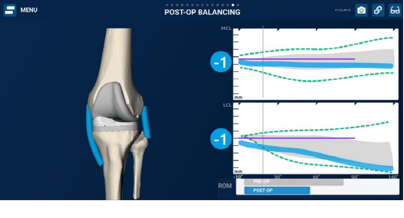 chirurgie prothétique du genou Avignon