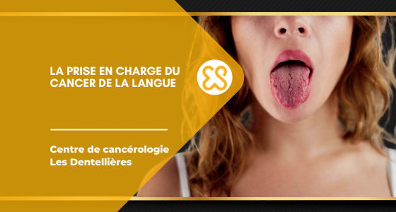 Prise en charge cancer de la langue