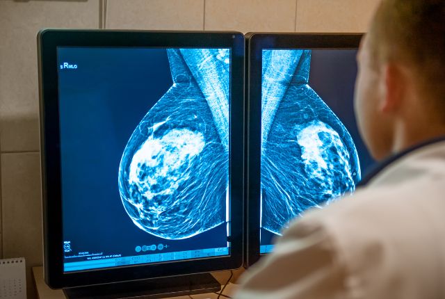 Quel examen pour détecter un cancer ? Un soignant étudie des images issues de mammographie.