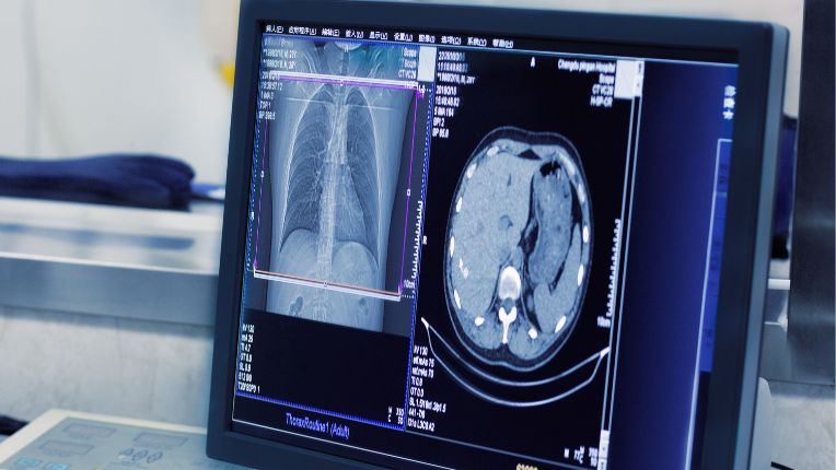 Différence entre radio et scanner ? On voit sur un écran les images obtenues d'un scanner, en plusieurs dimensions.