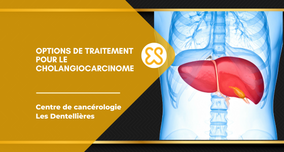Options de traitement pour le cholangiocarcinome