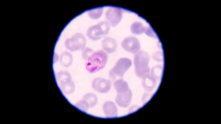 Centre de vaccination internationale (CVI) Toulouse. Image de l'agent du paludisme au milieu des cellules sanguines, au microscope.