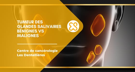Tumeur des glandes salivaires : bénignes vs malignes