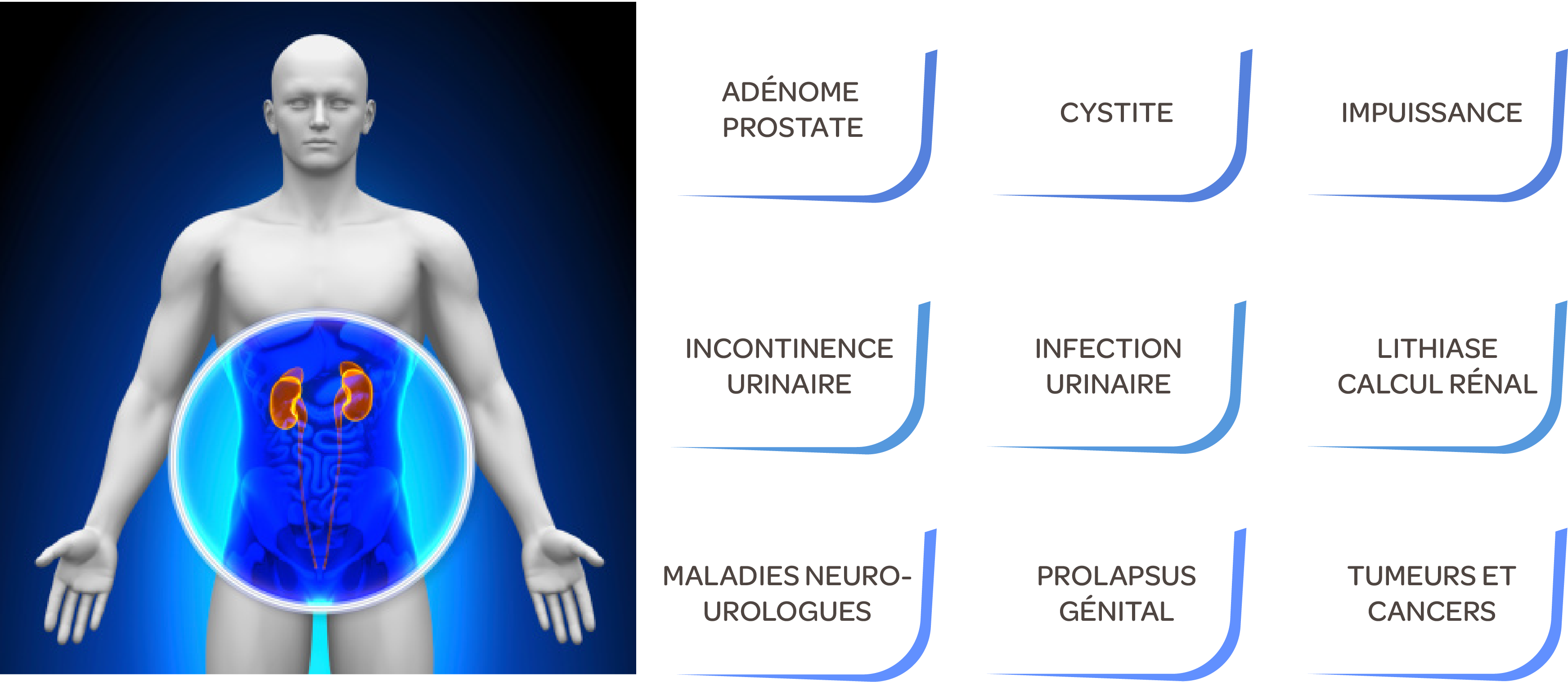 urologie