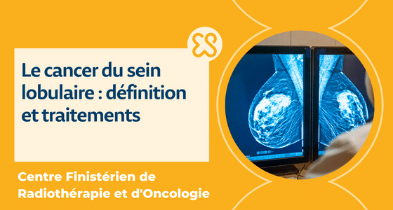 Cancer sein lobulaire carcinome