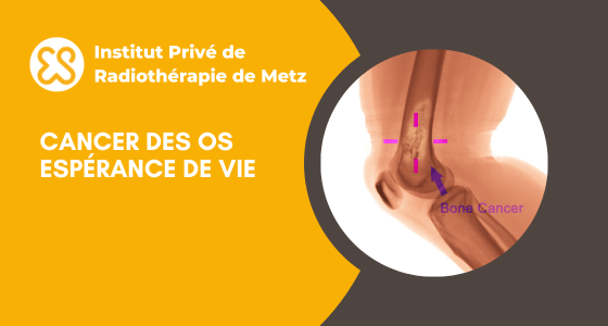 Cancer des os - Espérance de vie