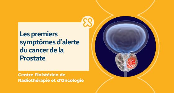 cancer de la prostate - premiers symptômes d'alerte