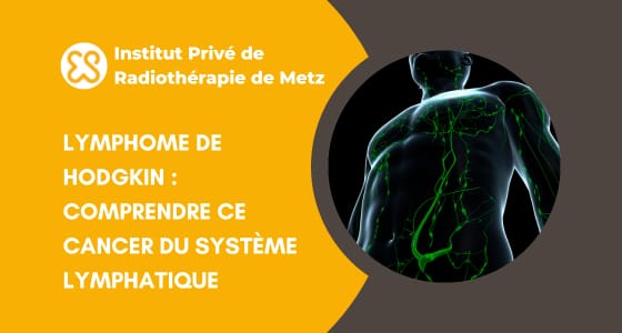 Lymphome de Hodgkin - Cancer du système lymphatique