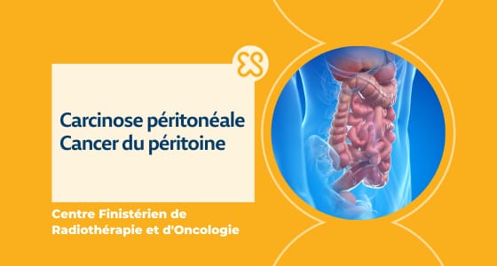Cancer du péritoine