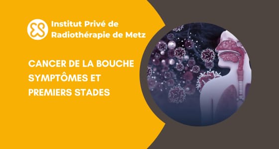 Cancer de la bouche - symptômes et premiers stades