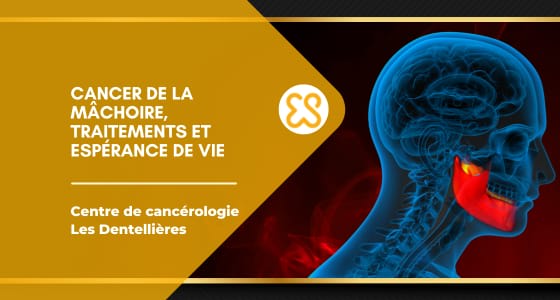 Cancer de la mâchoire, traitements et espérance de vie