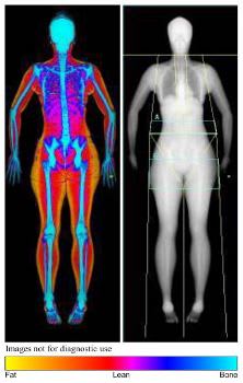 Body composition scan, Body scan near me