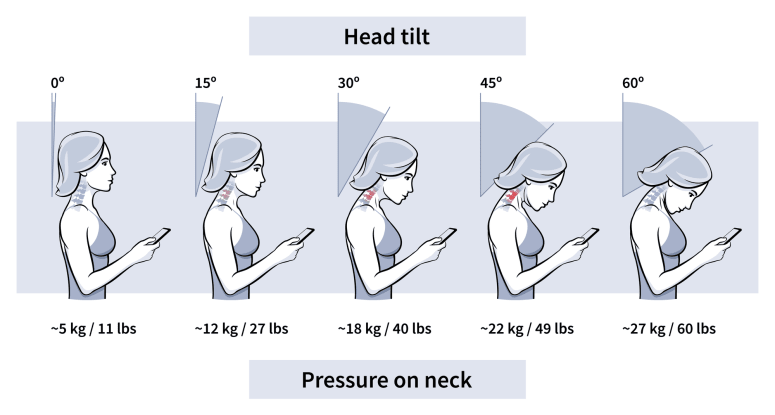 How to Fix Text Neck that is Killing your Good Posture