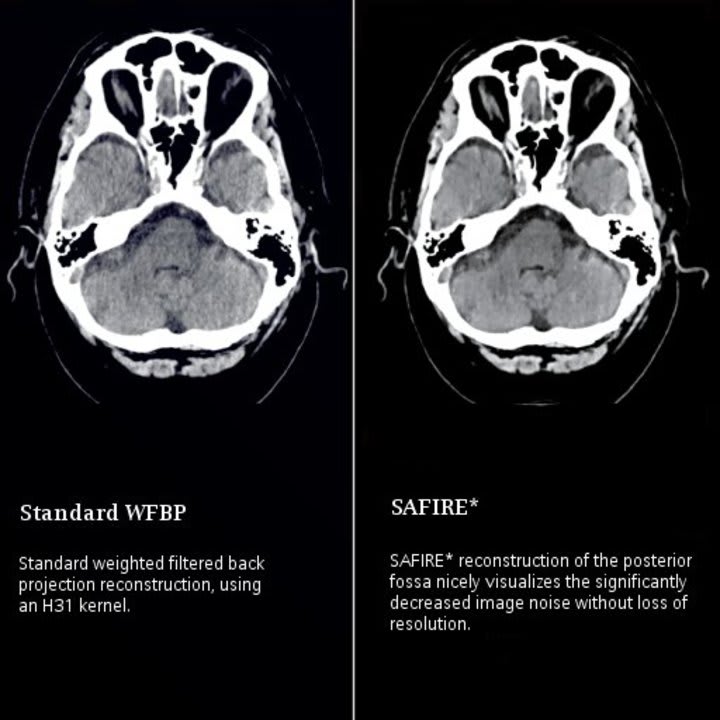 Medical Imaging & Radiology | Oswego Health | Oswego, New York