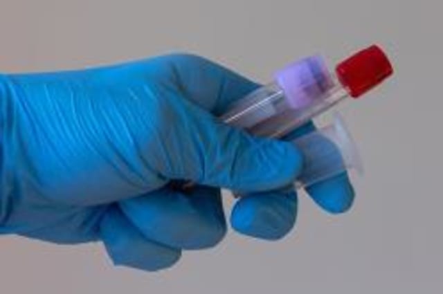 Rapid Testing