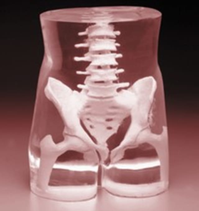 Skeleton