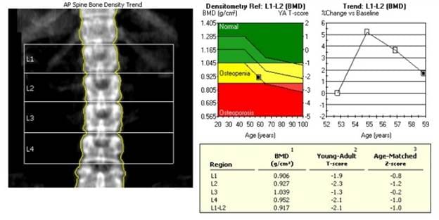 Scheurer Health Diagnostic Imaging | X-Ray, CT Scan, Mammogram | Pigeon, MI