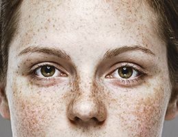 A close-up of someone's upper face.