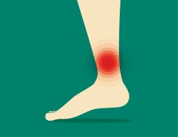 Lower leg with a radiating red spot on the ankle (illustration)