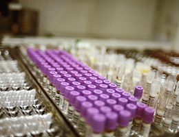 A group of test vials in a lab.