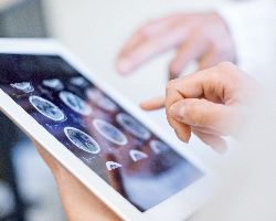 Hands gesture at a tablet displaying brain scans.