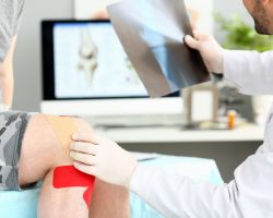 Provider touching knee while holding an x-ray.