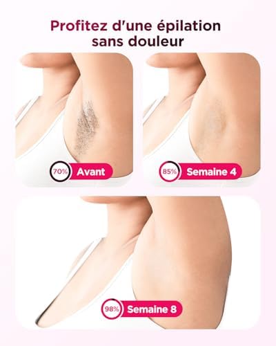 Vue 4 de Haarlosy Epilateur Lumiere Pulsee