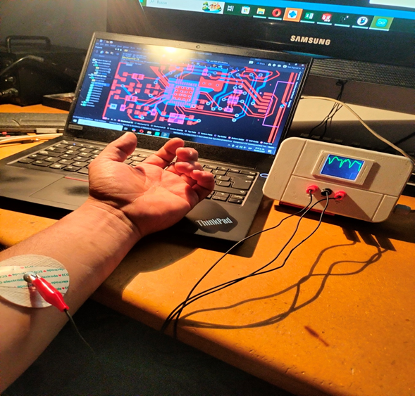 Desarrollo de electrocardiógrafo