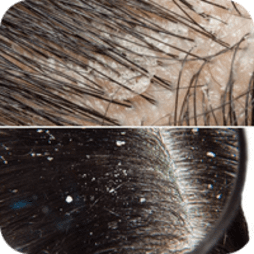 Scalp issues