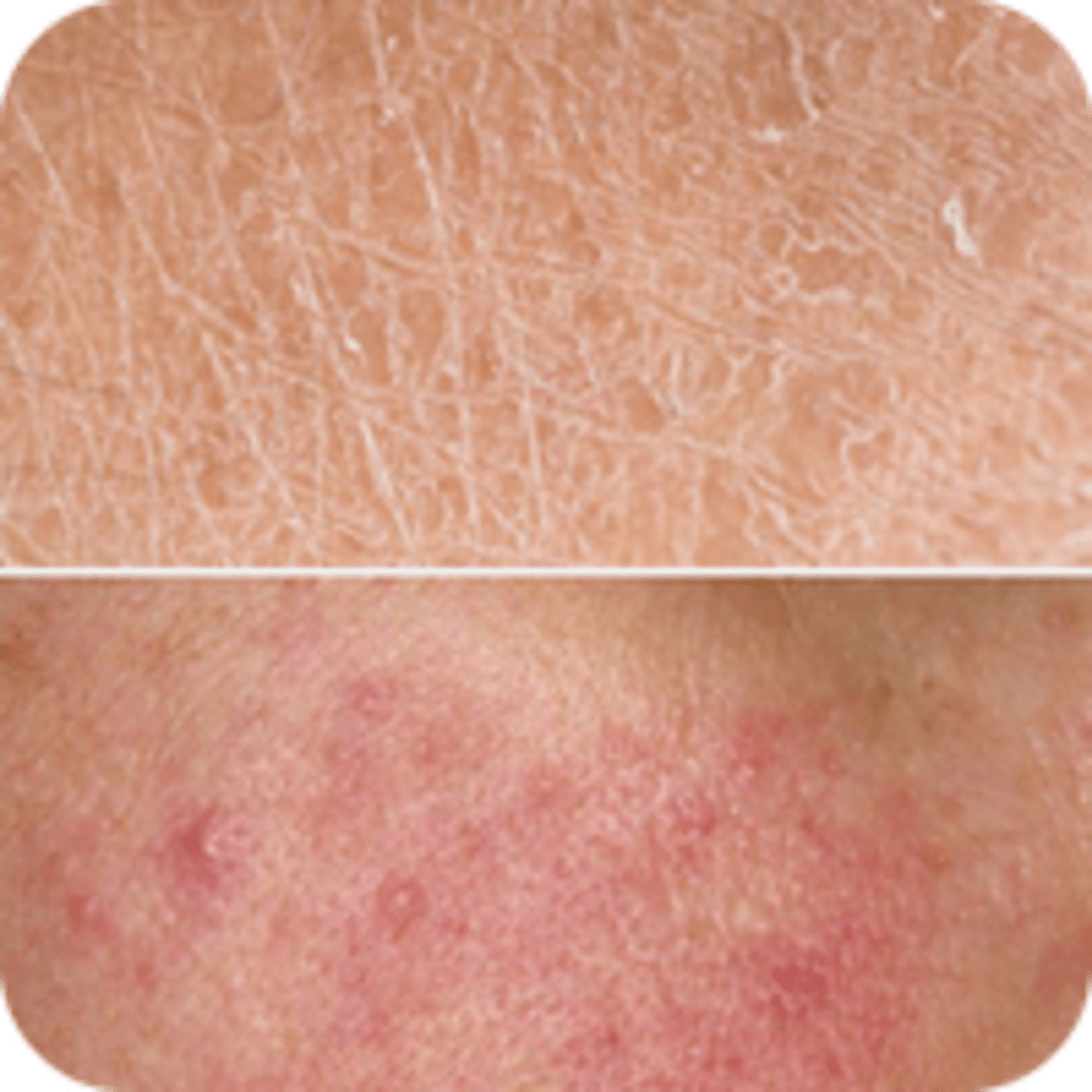 Skin damage