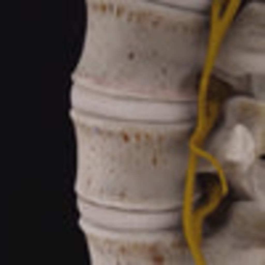 Lower back muscles holding in a protective brace