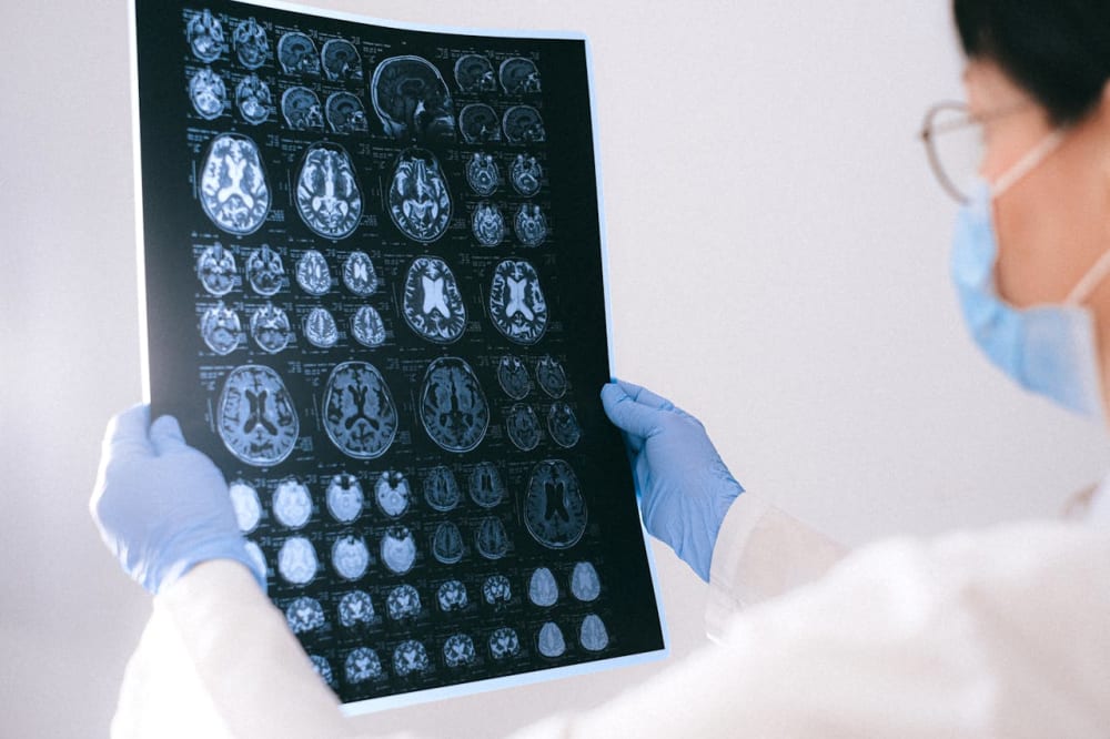 Nouveau traitement prometteur pour la maladie de Parkinson