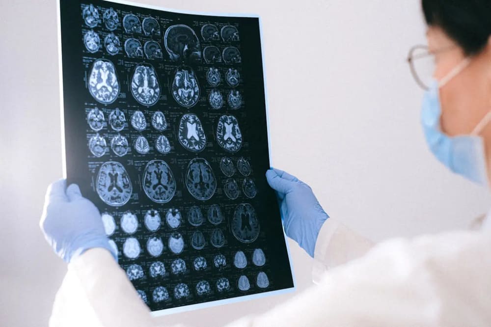 un médecin qui regarde une radiographie